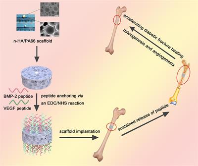 A Dual Peptide Sustained-Release System Based on Nanohydroxyapatite/Polyamide 66 Scaffold for Synergistic-Enhancing Diabetic Rats’ Fracture Healing in Osteogenesis and Angiogenesis